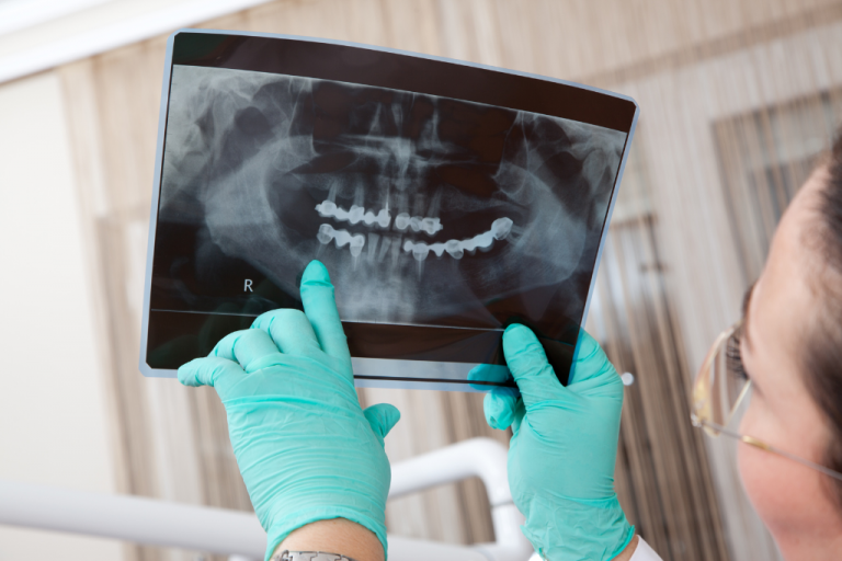 dentista observando una radiografía dental representando la importancia del seguimiento de los pacientes mediante las historias clínicas dentales